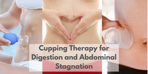 Cupping Therapy for Digestion and Abdominal Stagnation