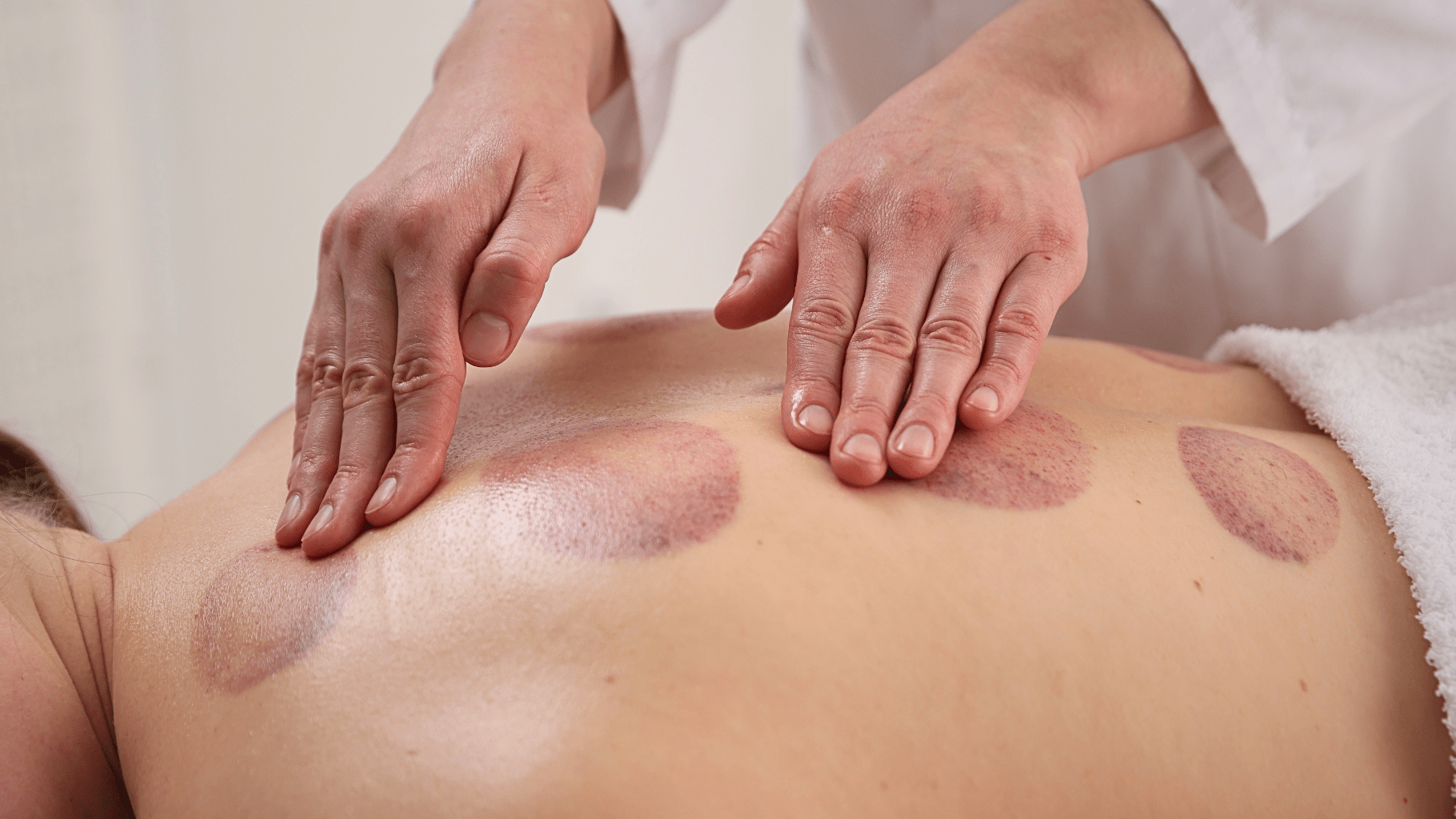 What Should You Not Do After Cupping?