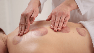What Should You Not Do After Cupping?