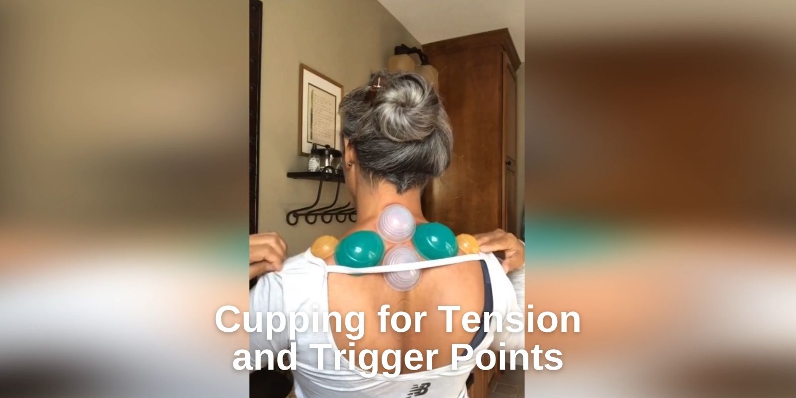 Cupping for the Neck Pain and Shoulder Tension
