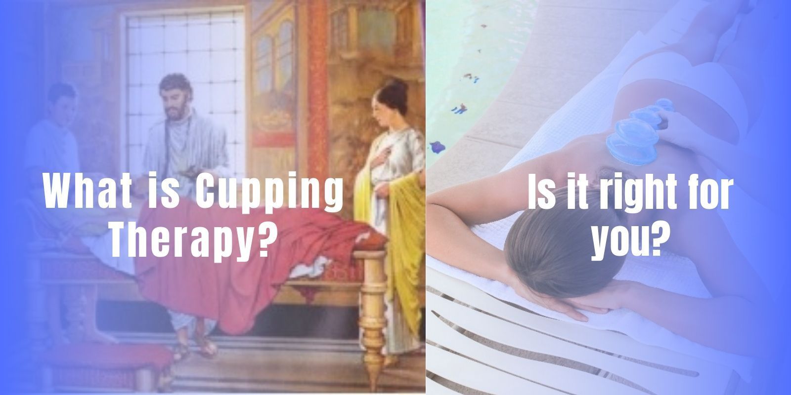 What is Cupping Therapy? Is Tt Right For You: Types and Benefits - Lure Essentials