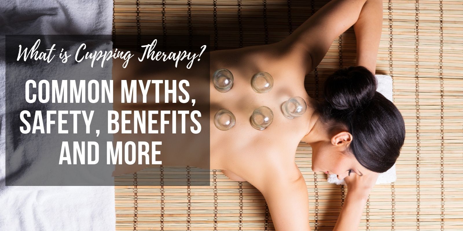 WHAT IS CUPPING THERAPY – COMMON MYTHS, SAFETY, BENEFITS AND MORE
