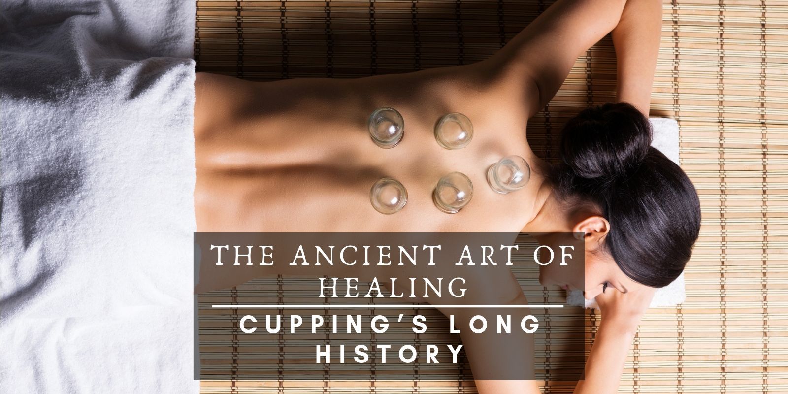 The Ancient Art of Healing – Cupping’s Long History