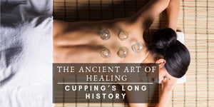 The Ancient Art of Healing – Cupping’s Long History