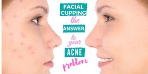 Acne Answers