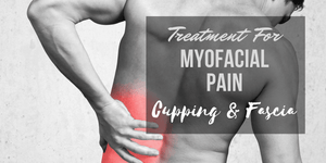 Treatment for Myofascial Pain – Cupping & Fascia