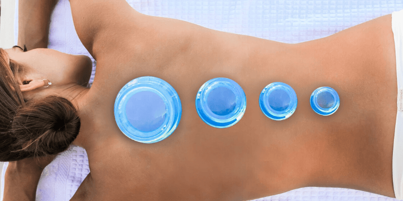 What is Cupping Therapy? - Lure Essentials