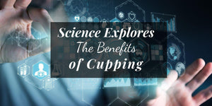 Does Cupping Work? Science Explores the Benefits of Cupping