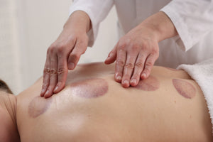 Why Cupping Leaves Marks and How to Care for Your Skin After
