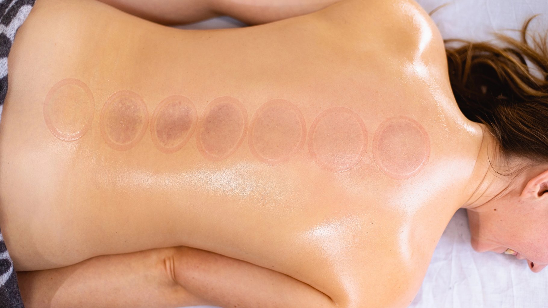 What to Expect During Your First Cupping Session