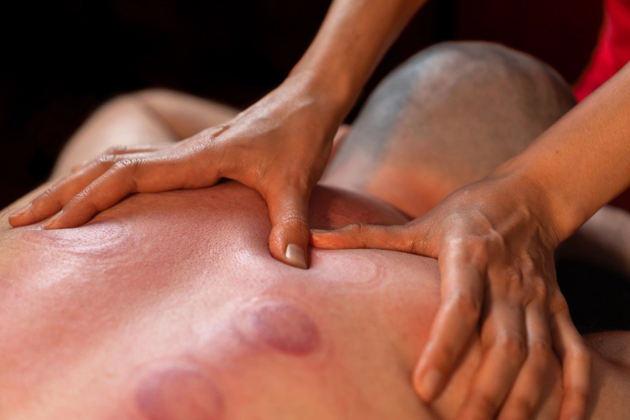 How Does Cupping Help Your Body Heal and Recover