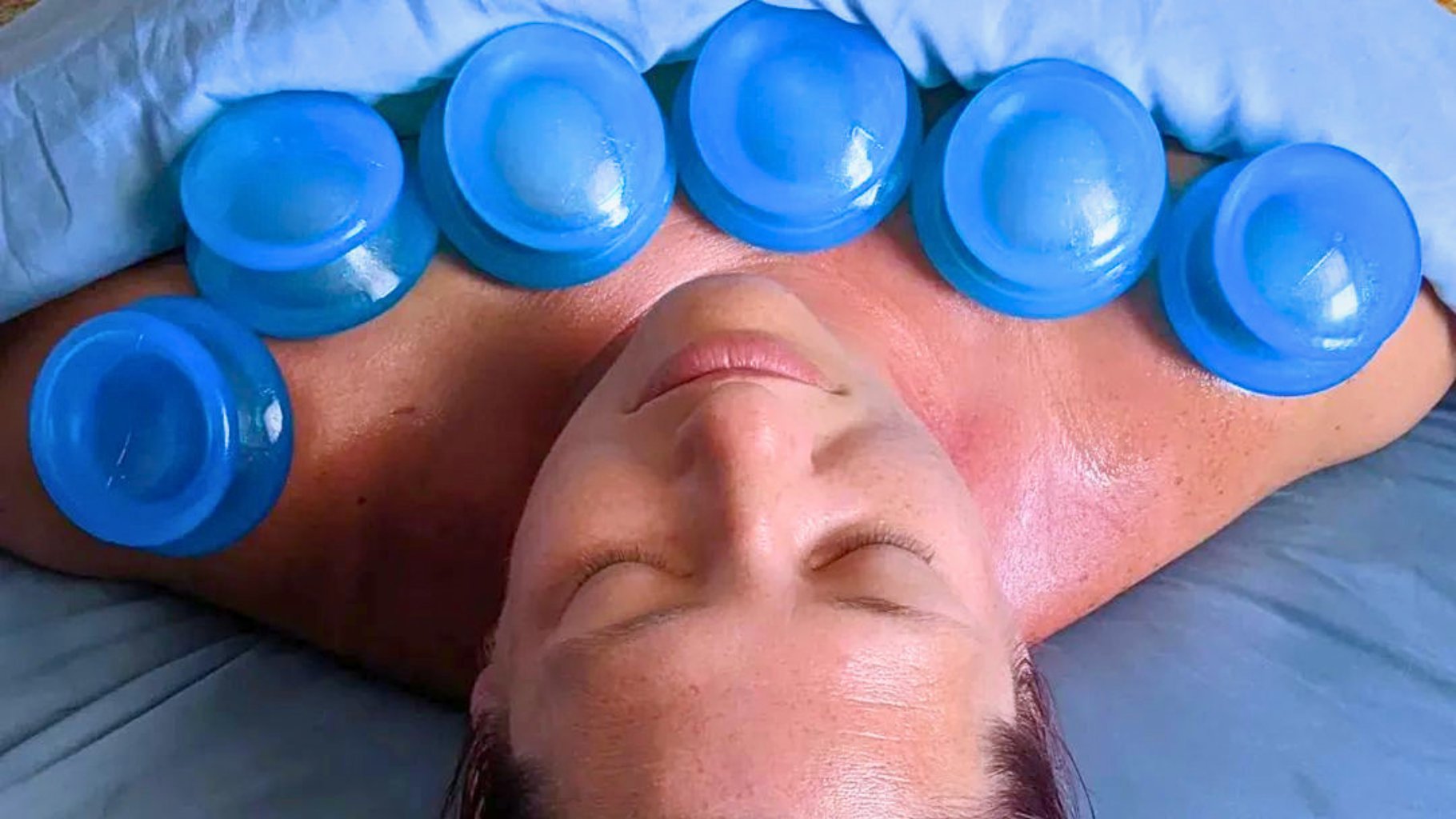 How Often Is Too Often for Cupping