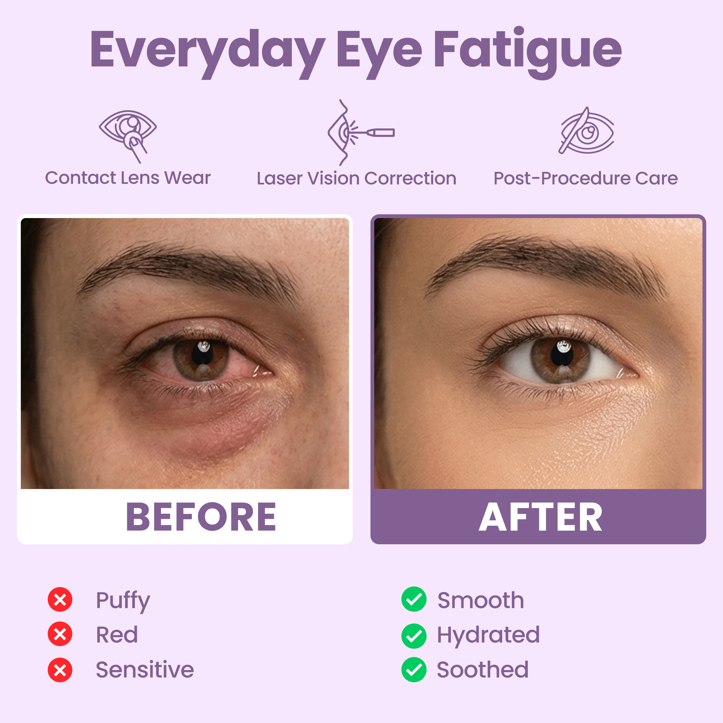 Eye Serenity Steam Eye Mask - LAVENDER