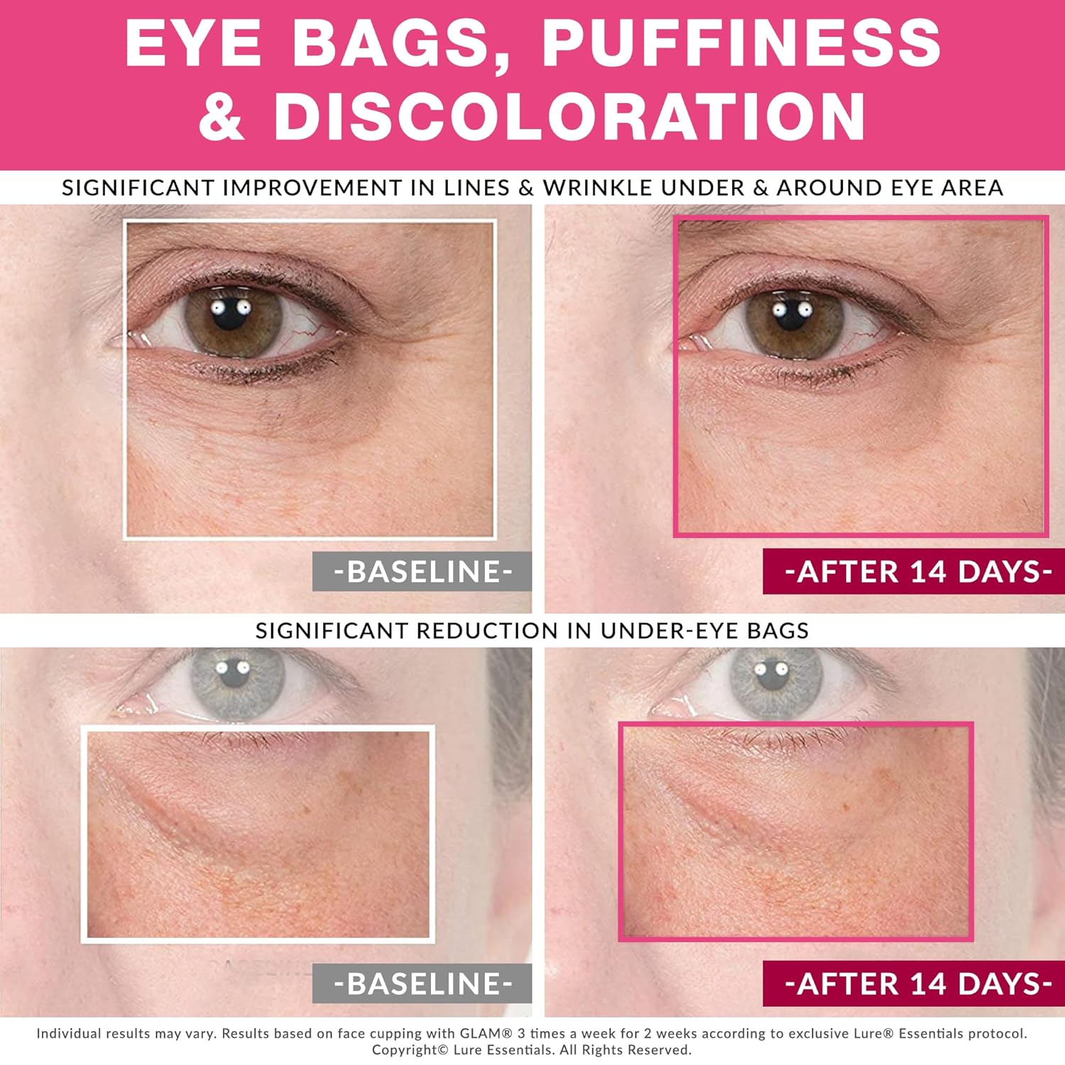 GLAM Facial Cupping Set, Face Eyes Lips