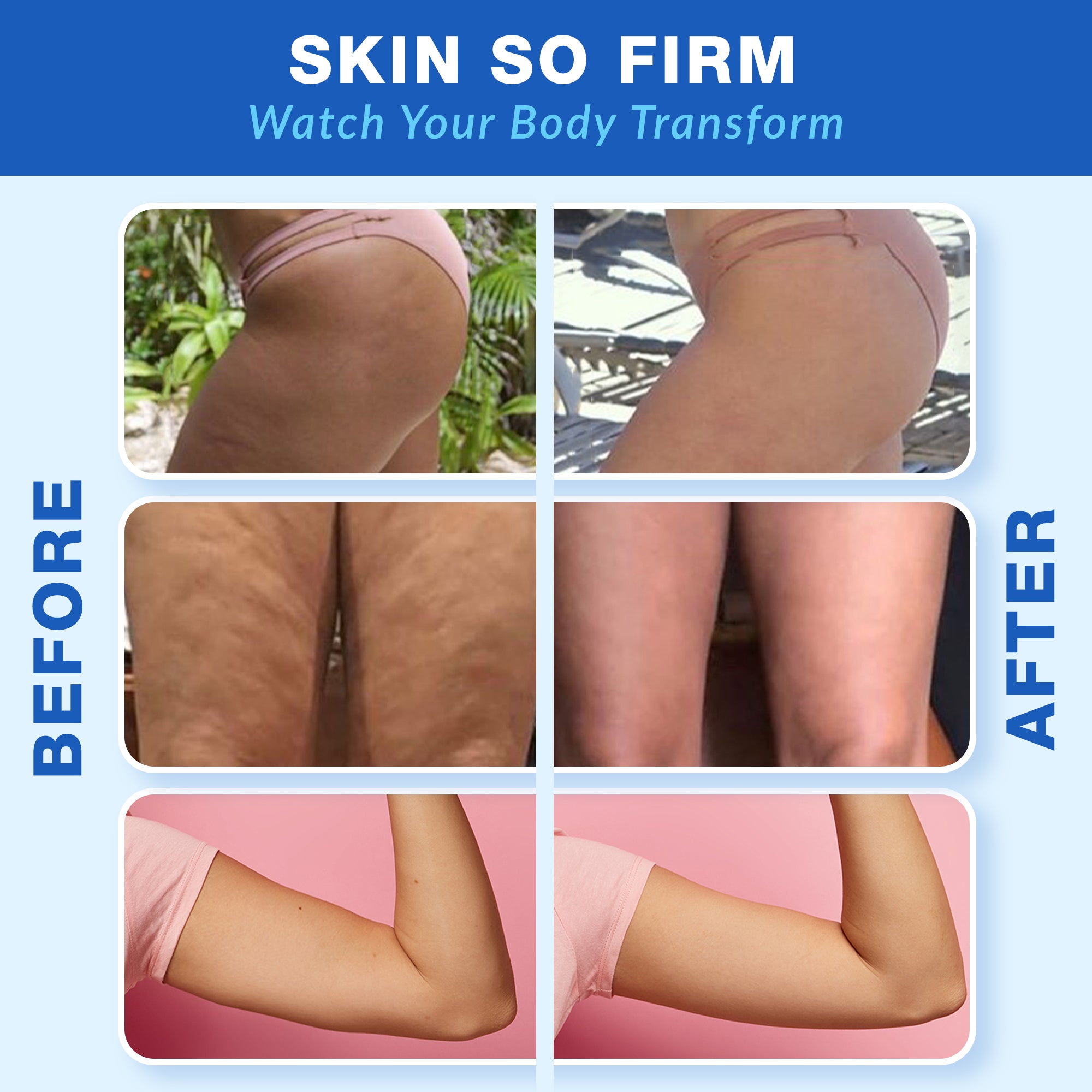 Cellulite Body Firming Gel