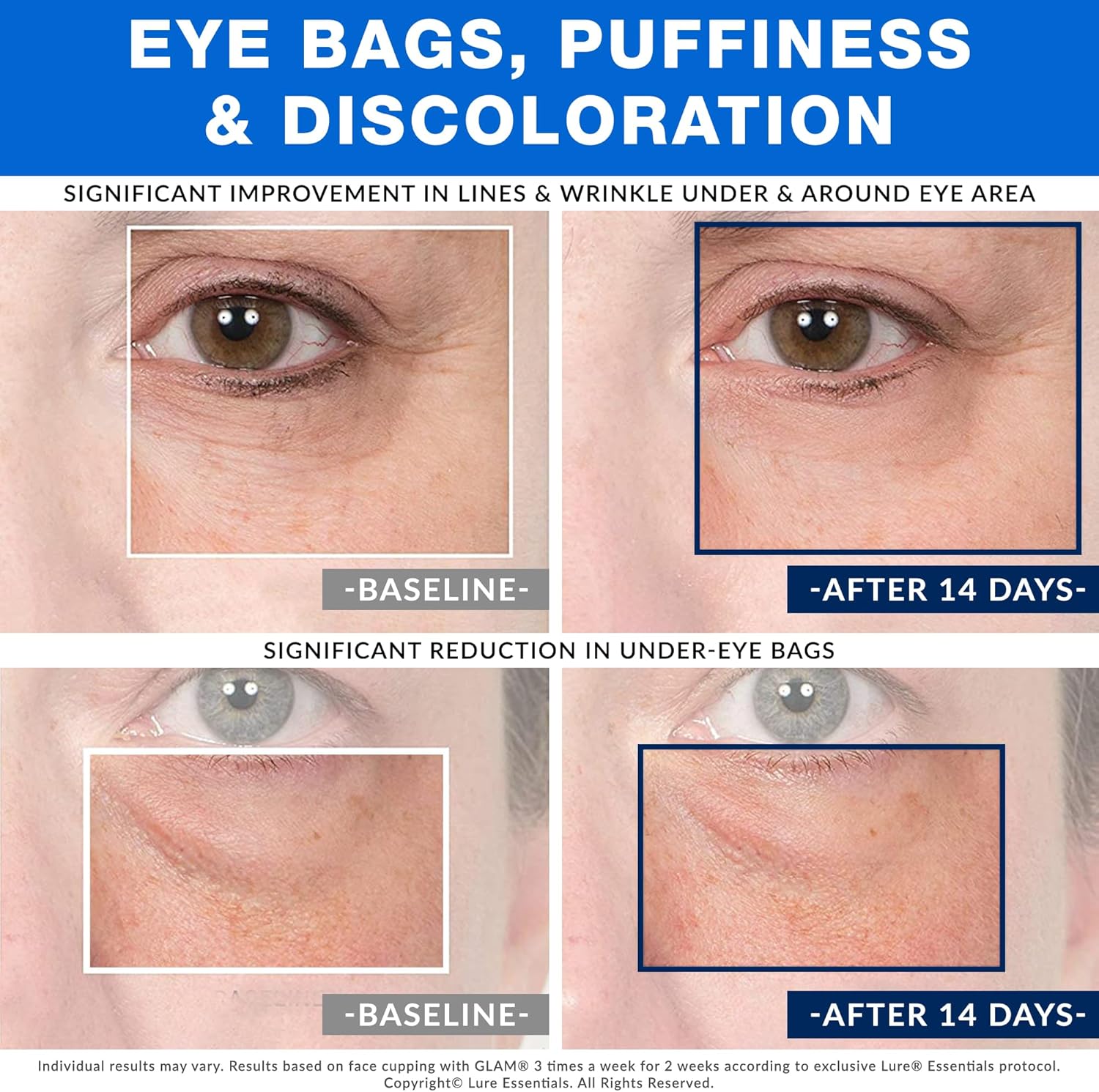 Glass Cupping Cup for Eyes, Nose Lips, Size 4