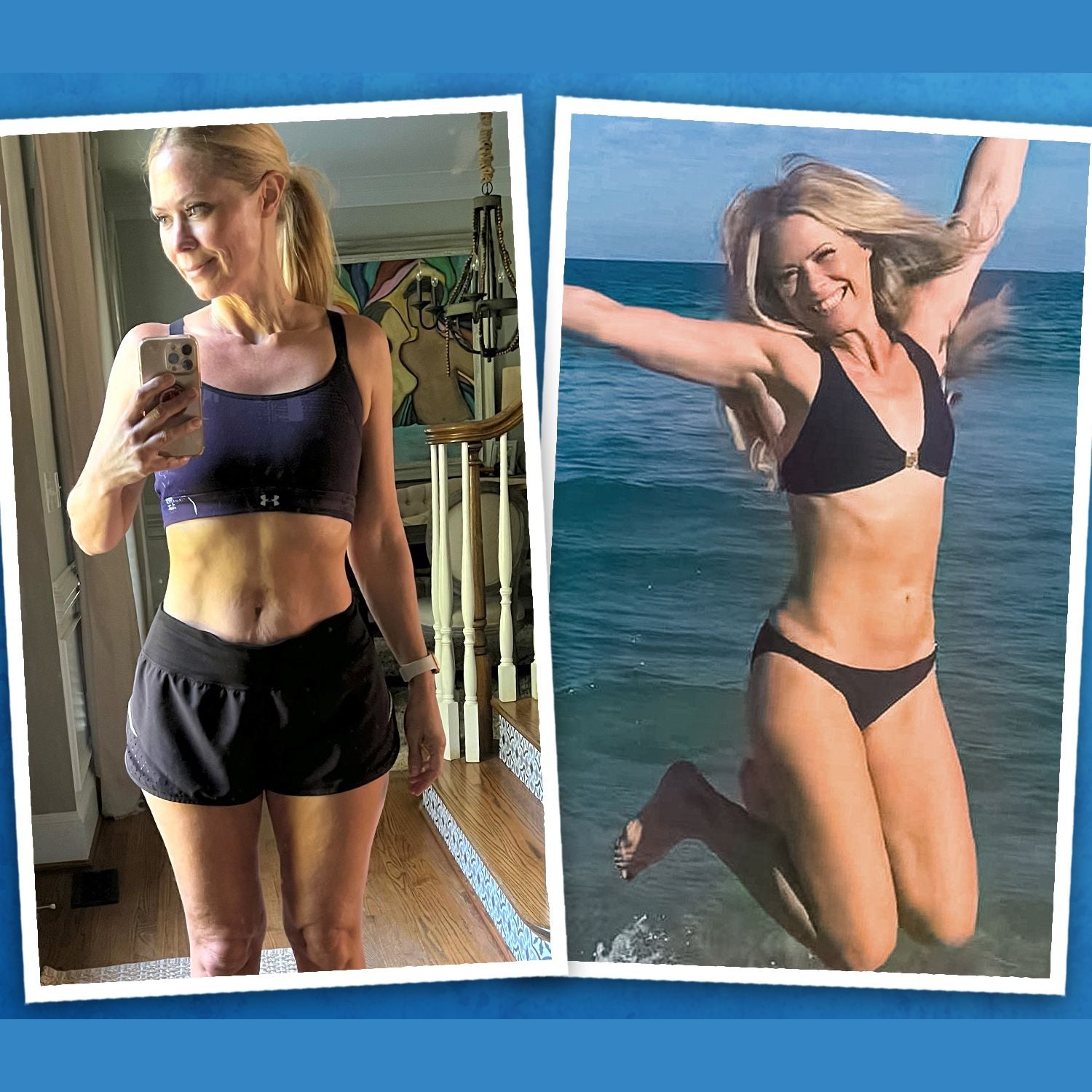 SCULPT Cellulite Cupping Set