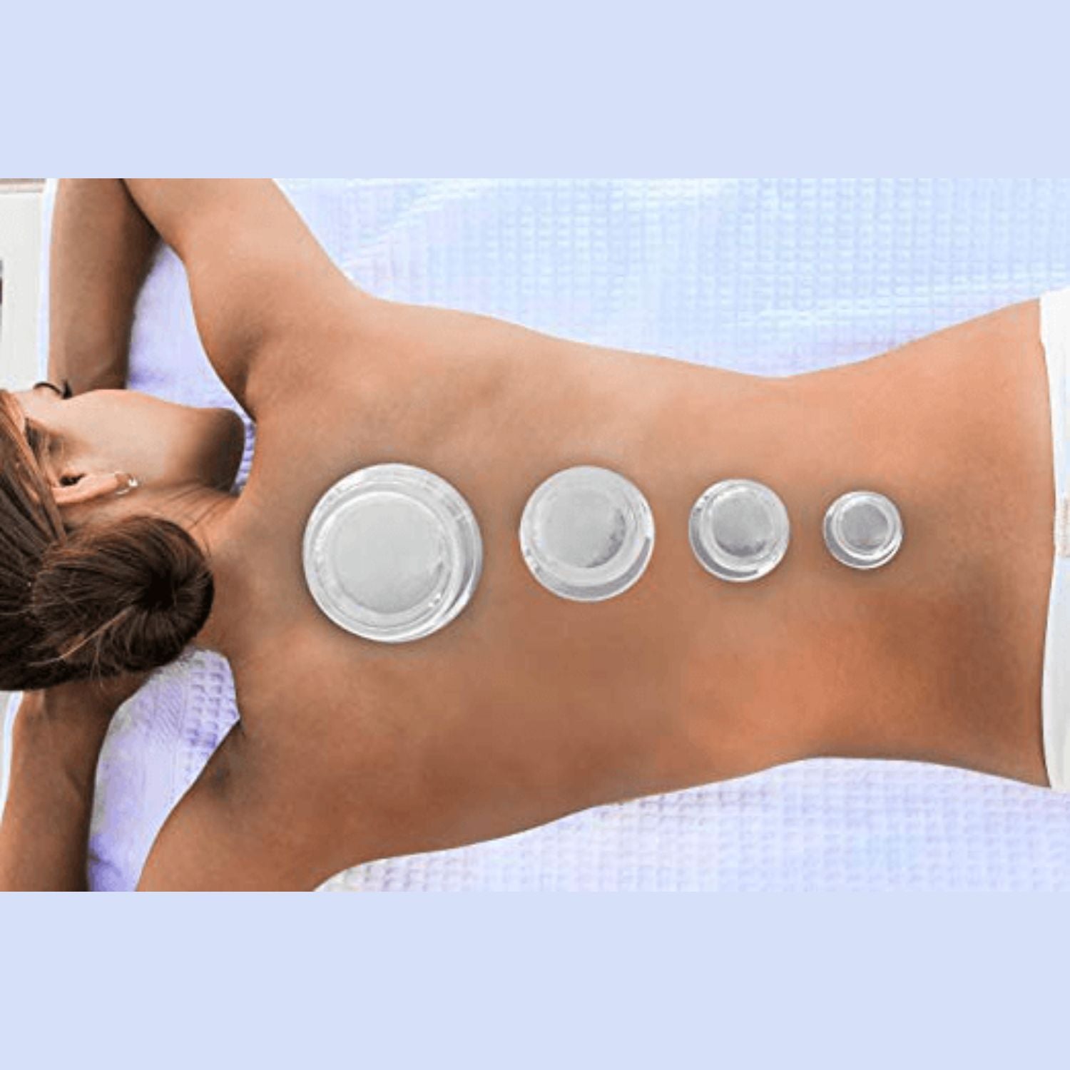 EDGE™ Cupping Therapy Set Clear, 6 Cups