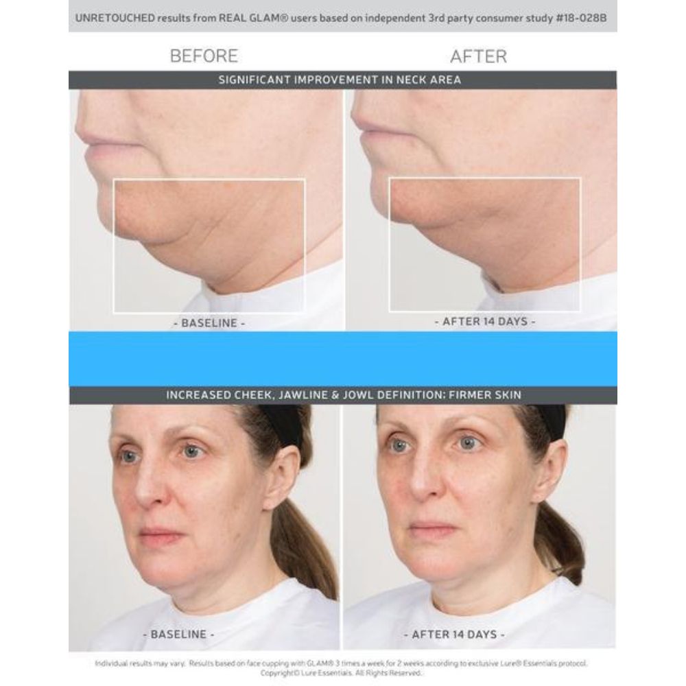 Shop Generic New V Face Shape Thin Face Lift Massager Face