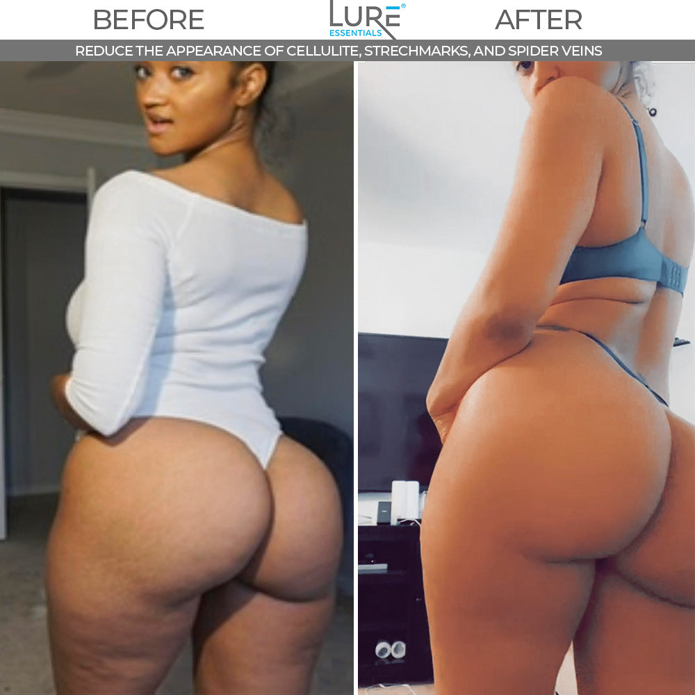 SCULPT Cellulite and Body Firming Cupping Set