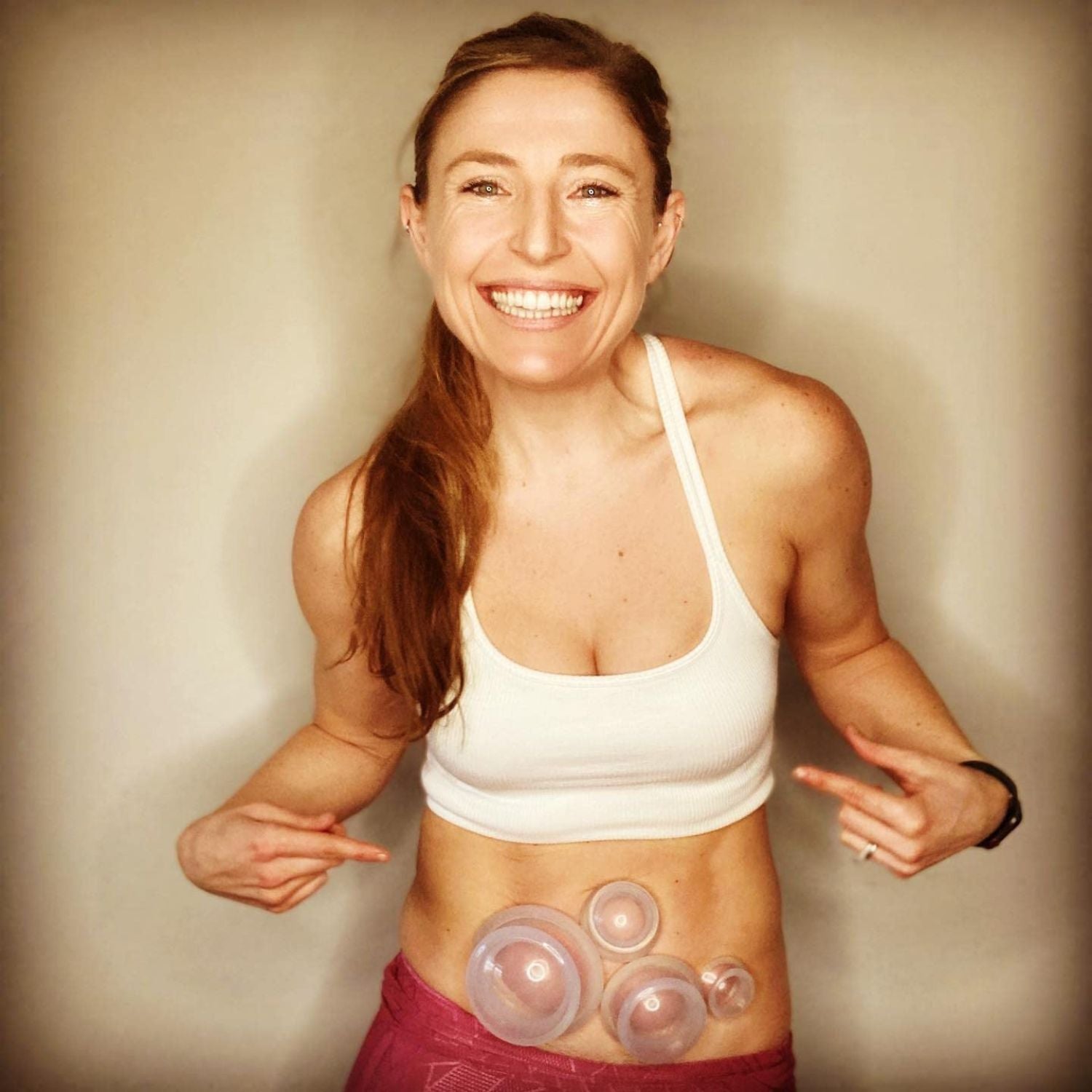 EDGE™ Cupping Set Clear, 8 Cups (2L, 2M, 4S)